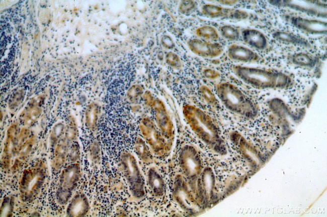 GPR105 Antibody in Immunohistochemistry (Paraffin) (IHC (P))