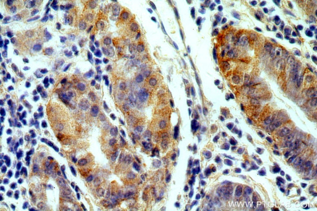 GPR105 Antibody in Immunohistochemistry (Paraffin) (IHC (P))