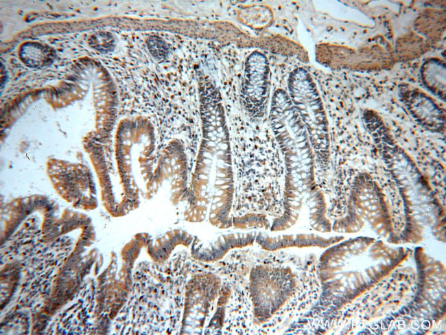 C11orf49 Antibody in Immunohistochemistry (Paraffin) (IHC (P))