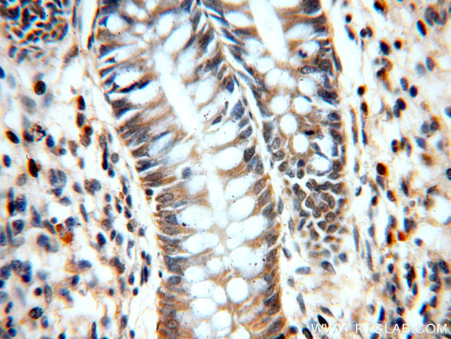 C11orf49 Antibody in Immunohistochemistry (Paraffin) (IHC (P))