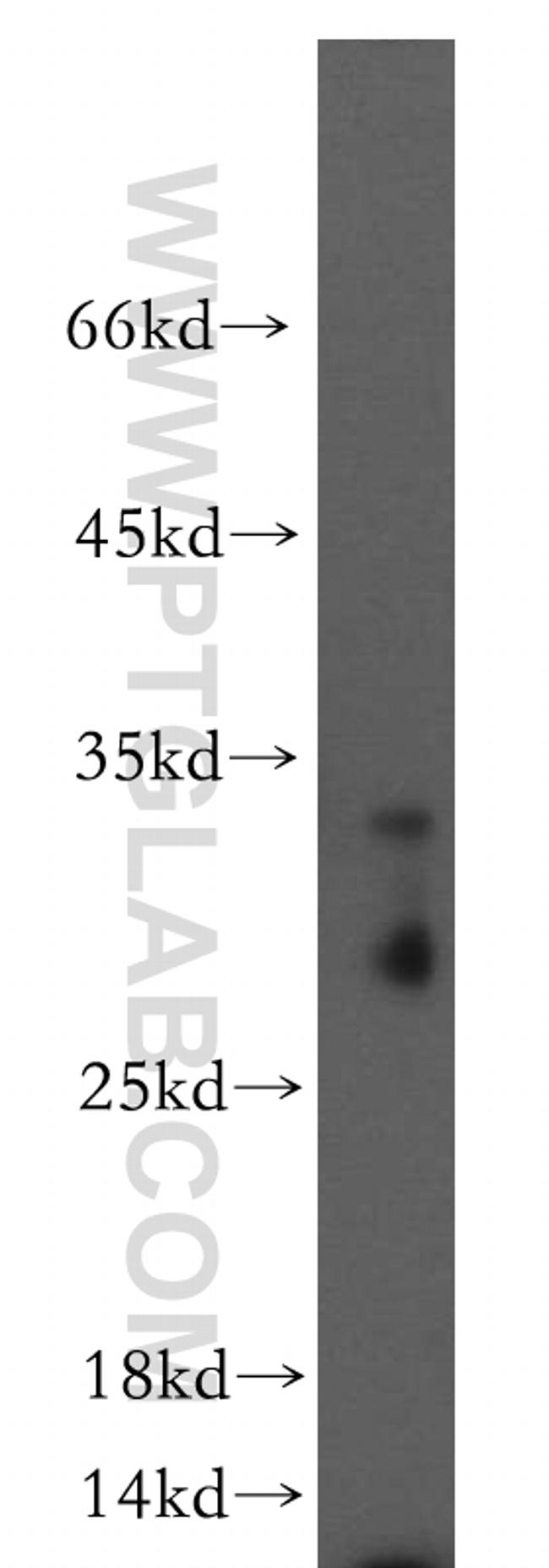 C11orf49 Antibody in Western Blot (WB)