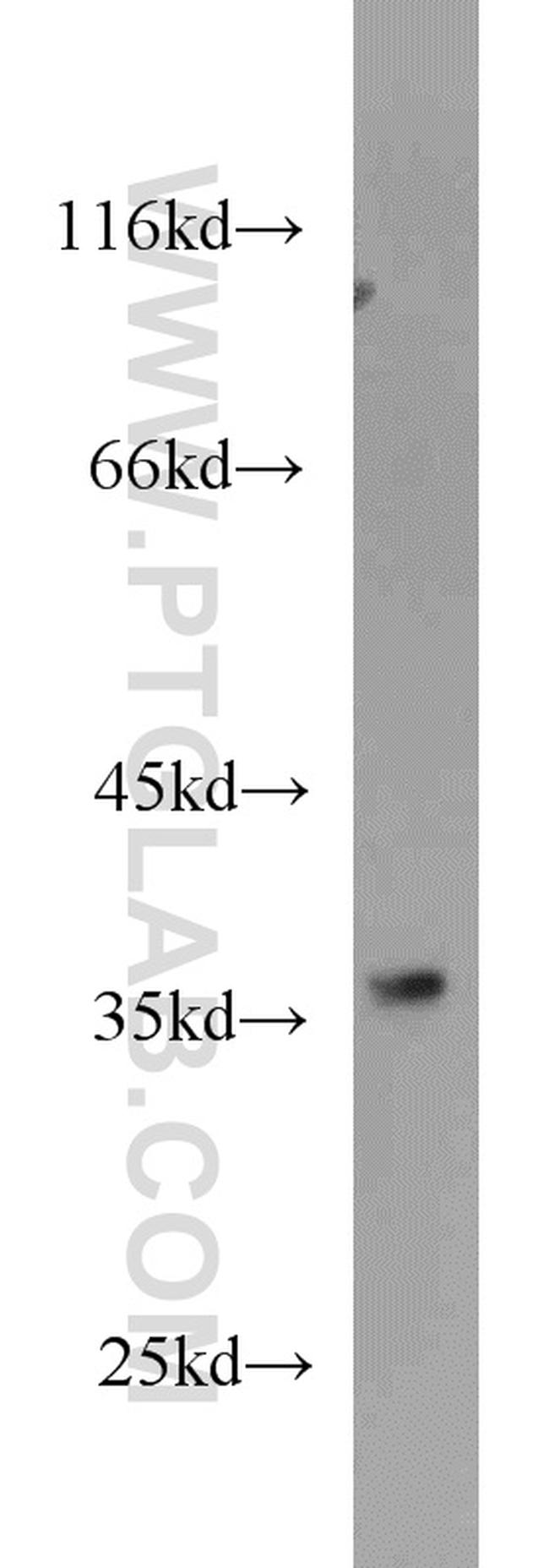 STEAP1 Antibody in Western Blot (WB)