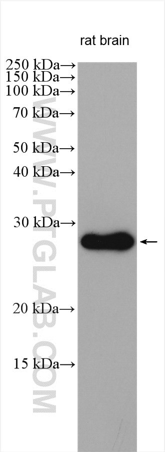 ZNRF2 Antibody in Western Blot (WB)