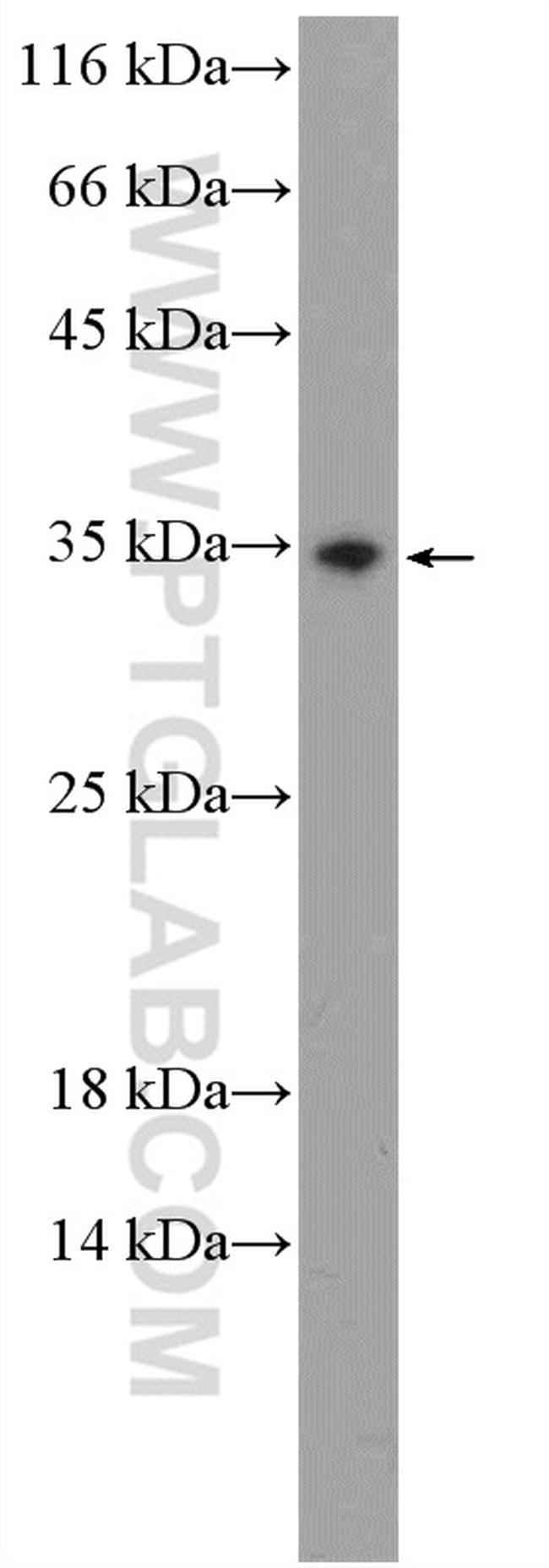 ZNRF2 Antibody in Western Blot (WB)