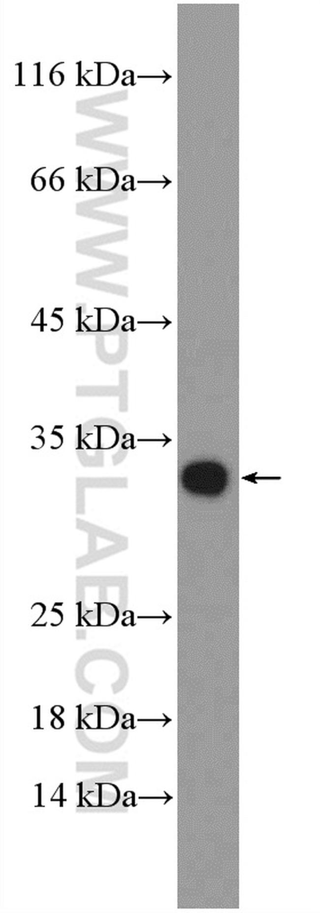 ZNRF2 Antibody in Western Blot (WB)