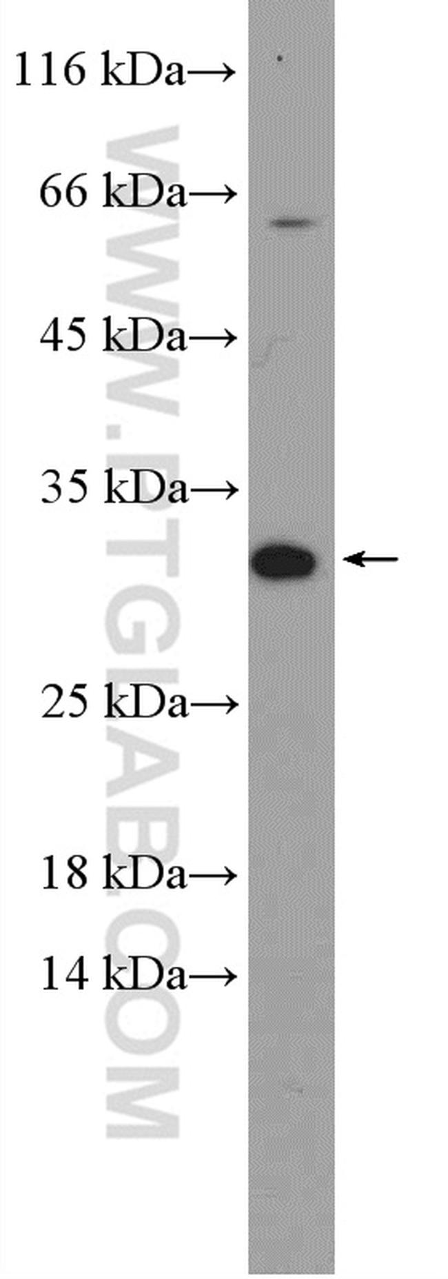 ZNRF2 Antibody in Western Blot (WB)