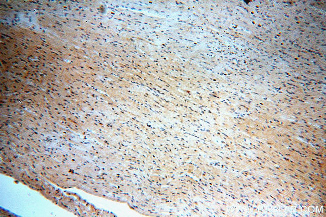 STEAP2 Antibody in Immunohistochemistry (Paraffin) (IHC (P))