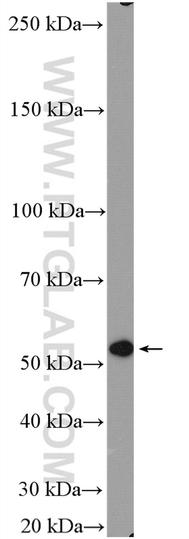 STEAP2 Antibody in Western Blot (WB)