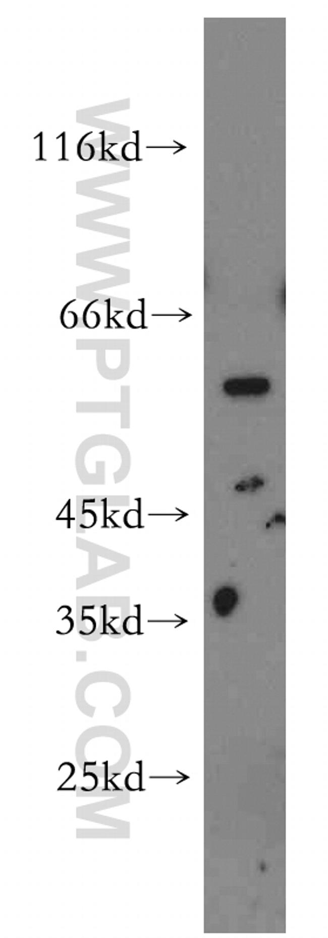 STEAP2 Antibody in Western Blot (WB)