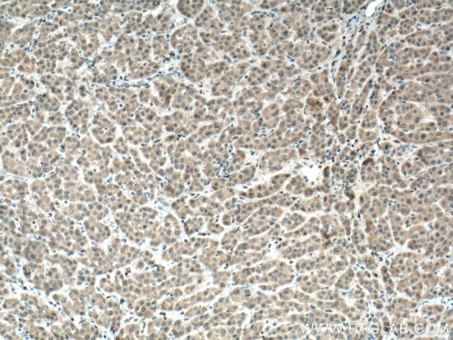 IGF1B Antibody in Immunohistochemistry (Paraffin) (IHC (P))