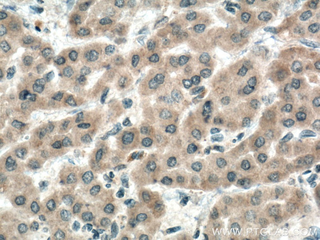 IGF1B Antibody in Immunohistochemistry (Paraffin) (IHC (P))