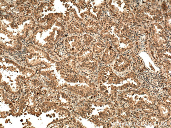 IGF1B Antibody in Immunohistochemistry (Paraffin) (IHC (P))