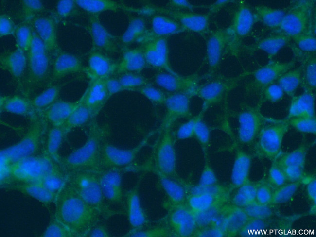 SLIT2 Antibody in Immunocytochemistry (ICC/IF)