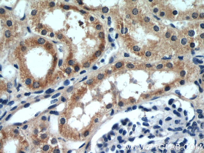 SLIT2 Antibody in Immunohistochemistry (Paraffin) (IHC (P))