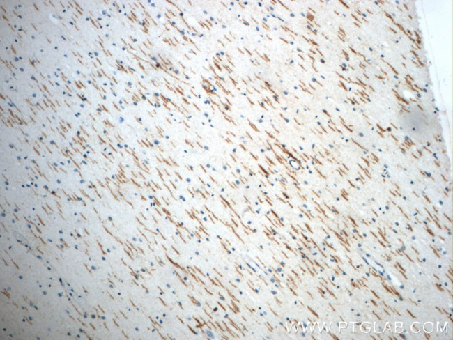 ROBO3 Antibody in Immunohistochemistry (Paraffin) (IHC (P))