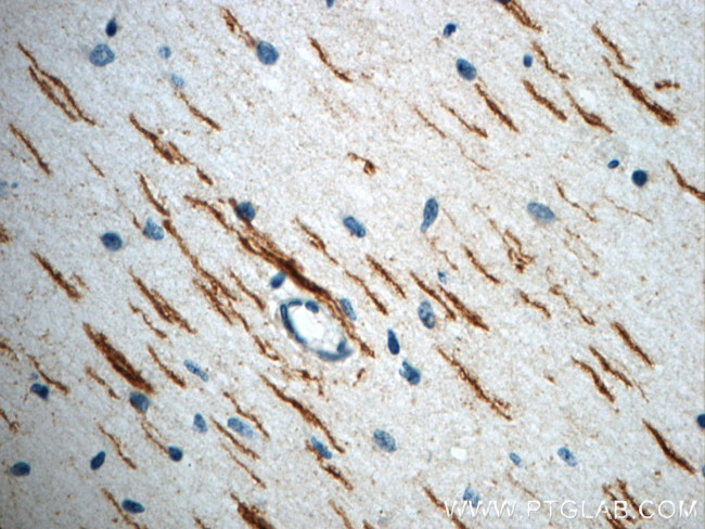 ROBO3 Antibody in Immunohistochemistry (Paraffin) (IHC (P))