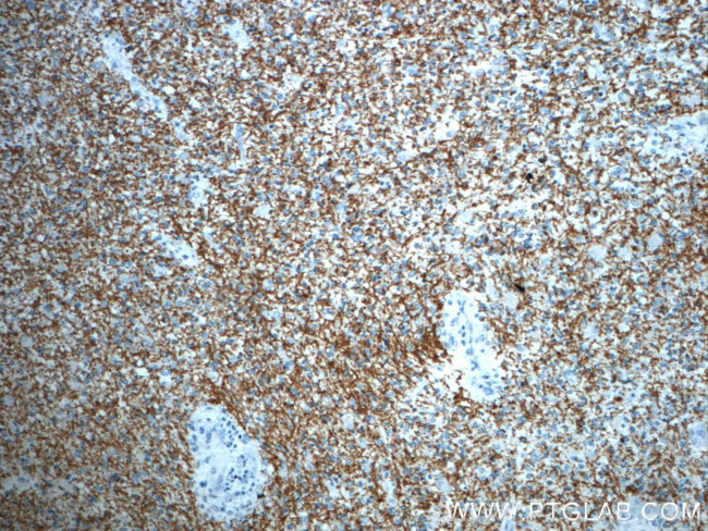 ROBO3 Antibody in Immunohistochemistry (Paraffin) (IHC (P))