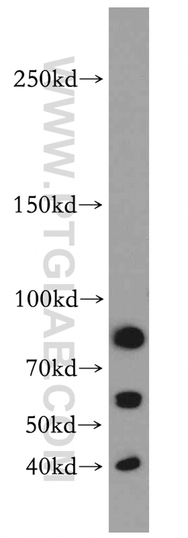 ROBO3 Antibody in Western Blot (WB)