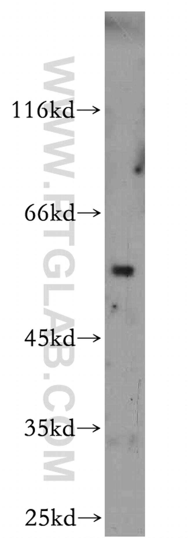 ROBO3 Antibody in Western Blot (WB)