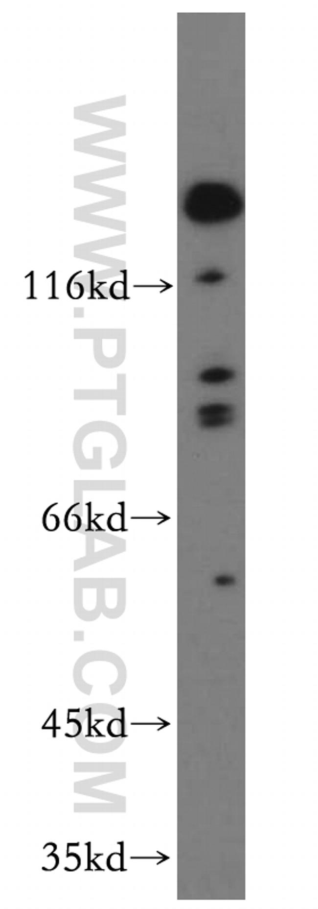 ROBO4 Antibody in Western Blot (WB)