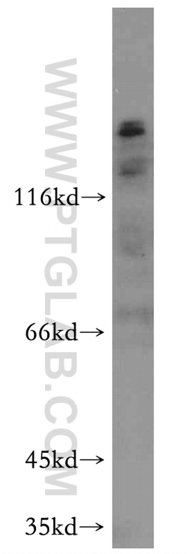 ROBO4 Antibody in Western Blot (WB)