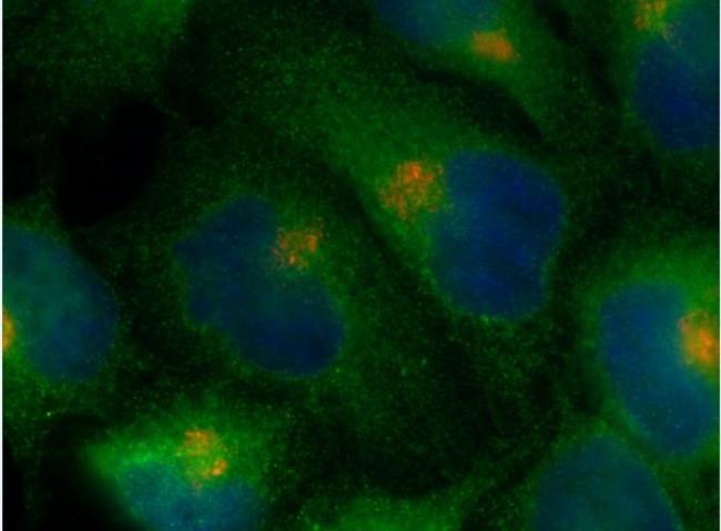 ARF6 Antibody in Immunocytochemistry (ICC/IF)