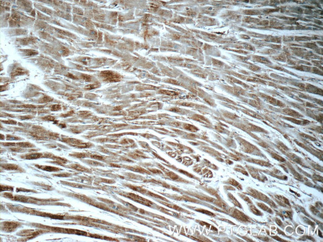 ARF6 Antibody in Immunohistochemistry (Paraffin) (IHC (P))