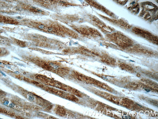 ARF6 Antibody in Immunohistochemistry (Paraffin) (IHC (P))