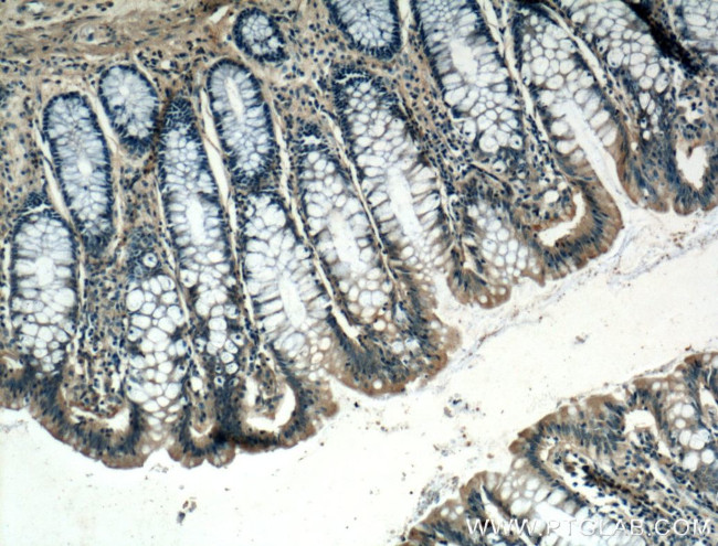 ARF6 Antibody in Immunohistochemistry (Paraffin) (IHC (P))