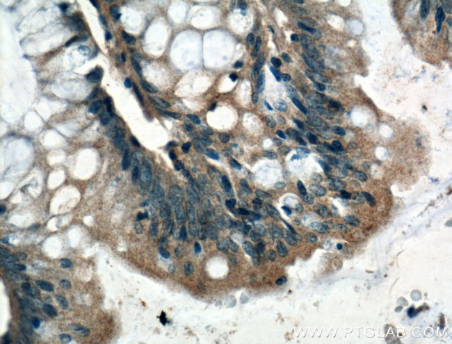 ARF6 Antibody in Immunohistochemistry (Paraffin) (IHC (P))