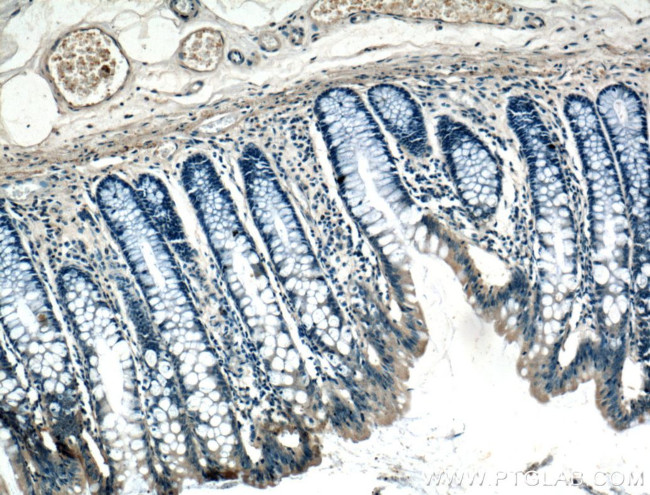 ARF6 Antibody in Immunohistochemistry (Paraffin) (IHC (P))