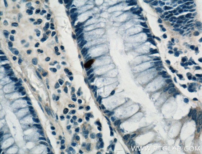 ARF6 Antibody in Immunohistochemistry (Paraffin) (IHC (P))