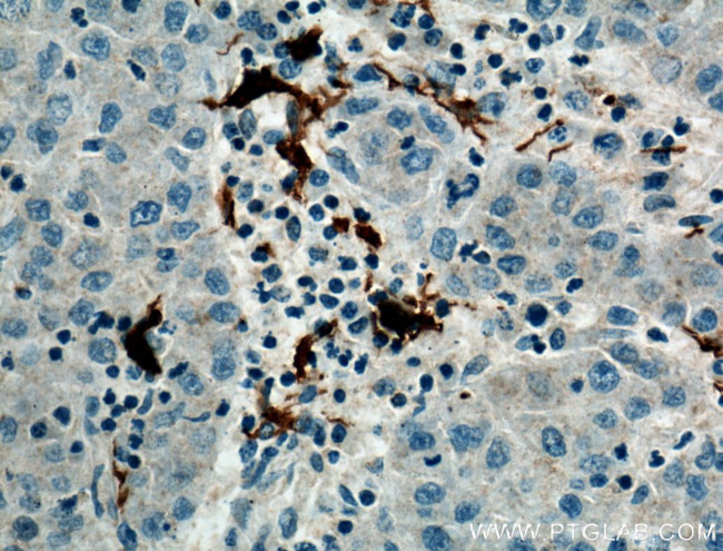 ARF6 Antibody in Immunohistochemistry (Paraffin) (IHC (P))