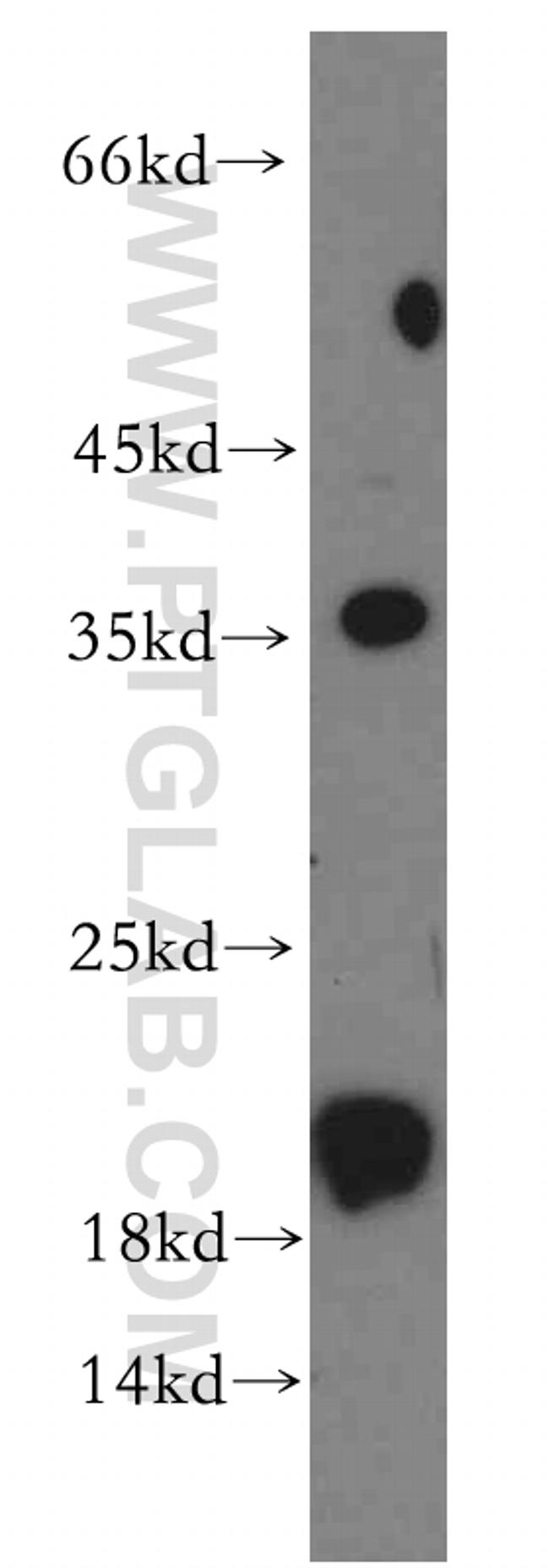 ARF6 Antibody in Western Blot (WB)