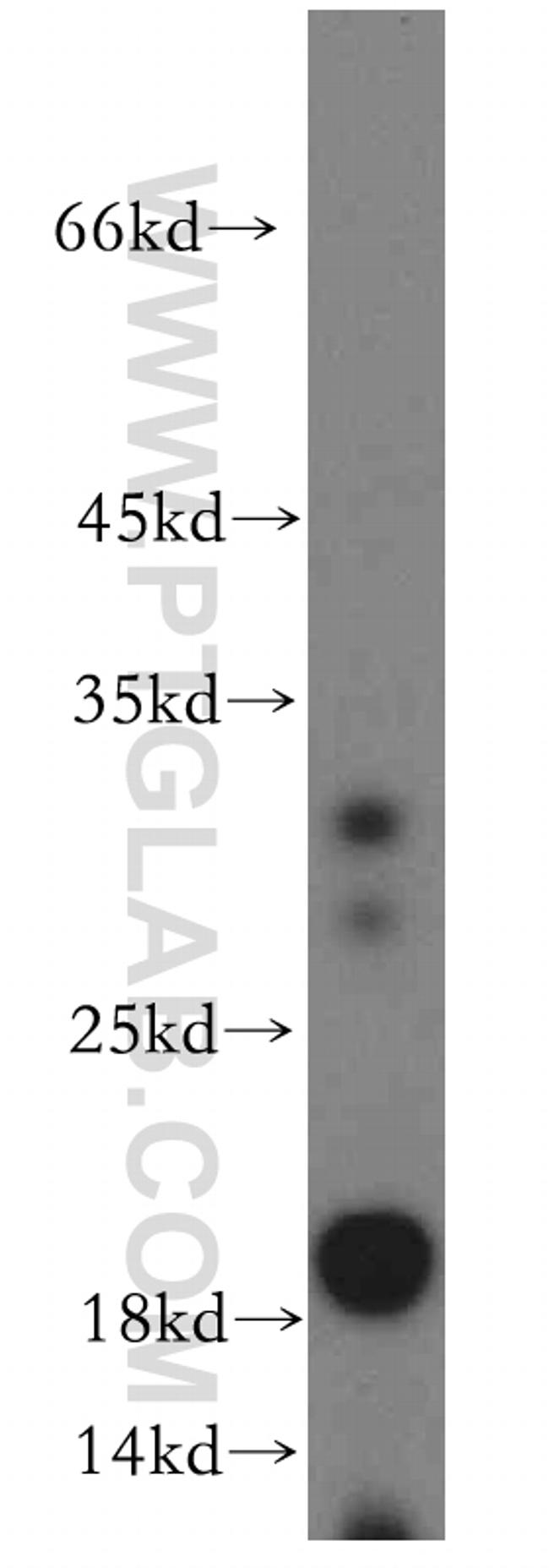 ARF6 Antibody in Western Blot (WB)