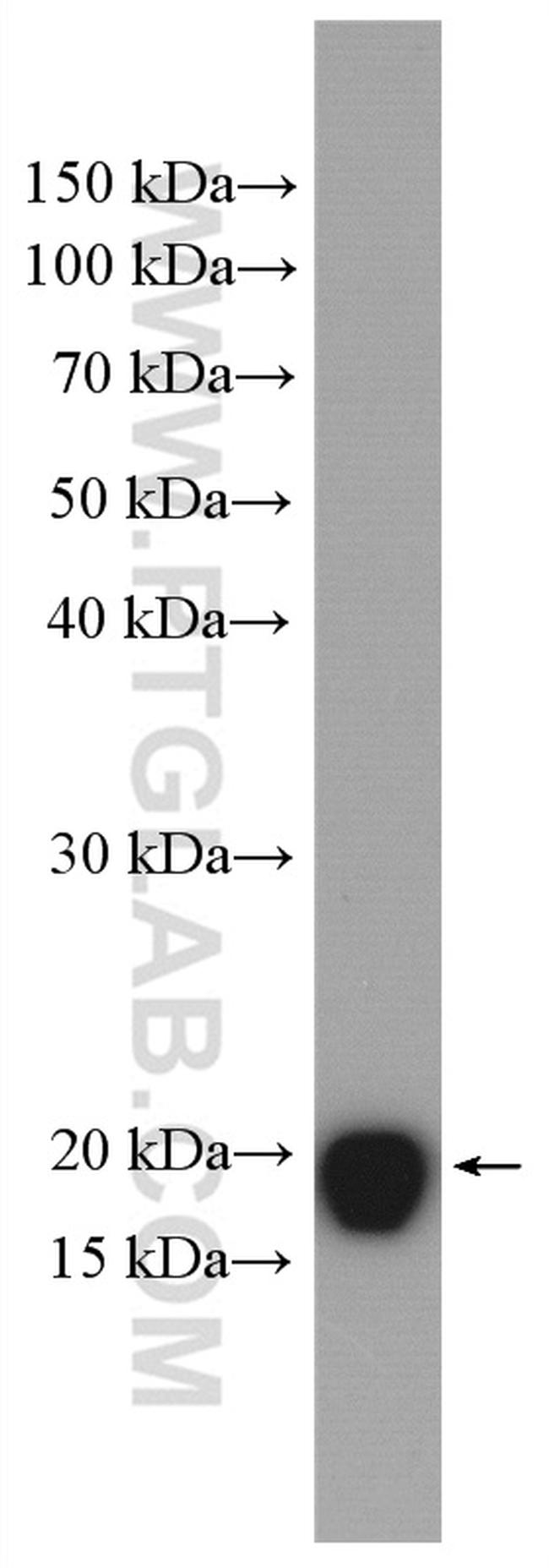 ARF6 Antibody in Western Blot (WB)