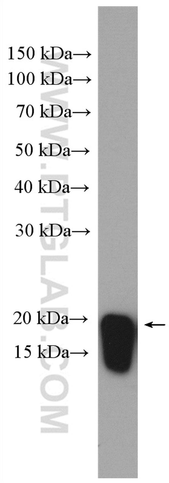 ARF6 Antibody in Western Blot (WB)