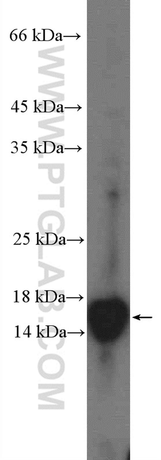 ARF6 Antibody in Western Blot (WB)