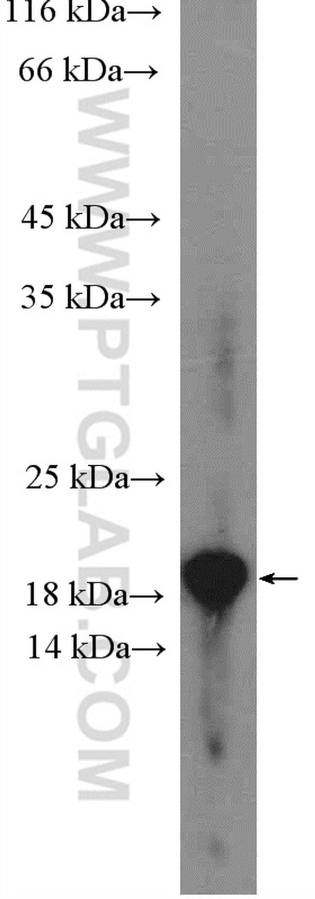 ARF6 Antibody in Western Blot (WB)