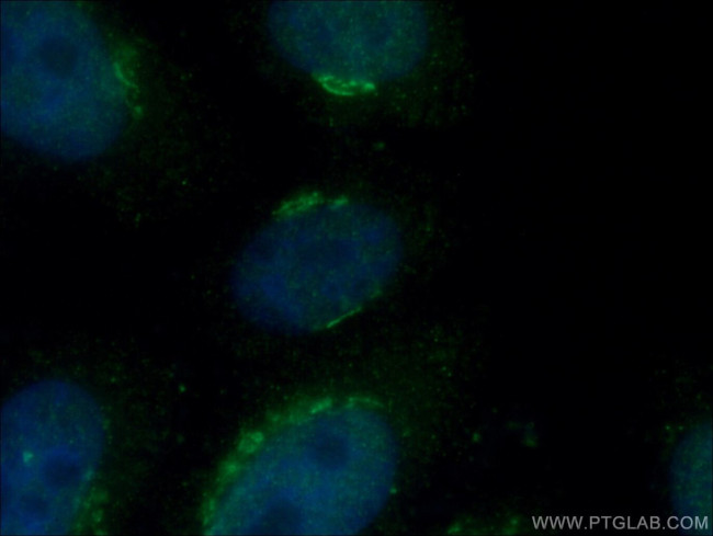 ARF1 Antibody in Immunocytochemistry (ICC/IF)