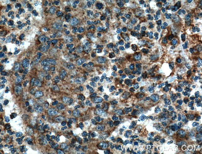 ARF1 Antibody in Immunohistochemistry (Paraffin) (IHC (P))