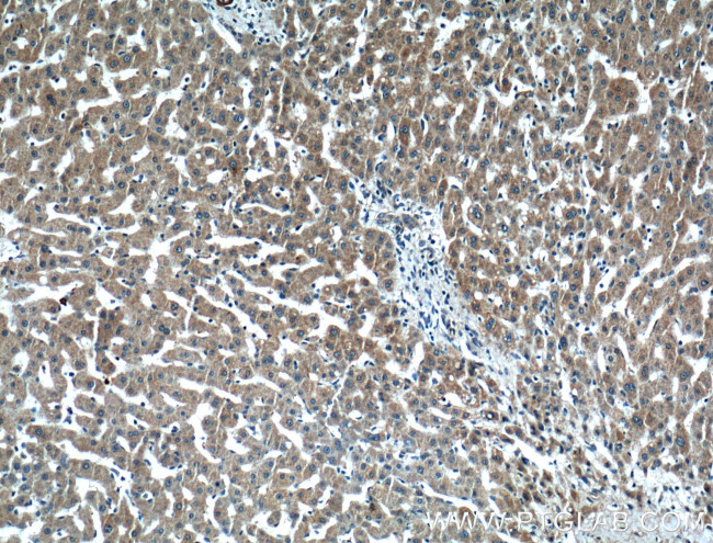 ARF1 Antibody in Immunohistochemistry (Paraffin) (IHC (P))