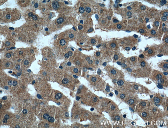 ARF1 Antibody in Immunohistochemistry (Paraffin) (IHC (P))