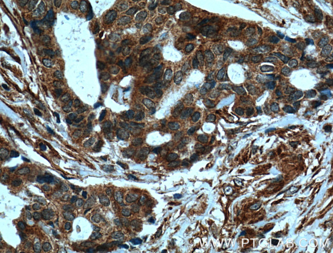 ARF1 Antibody in Immunohistochemistry (Paraffin) (IHC (P))