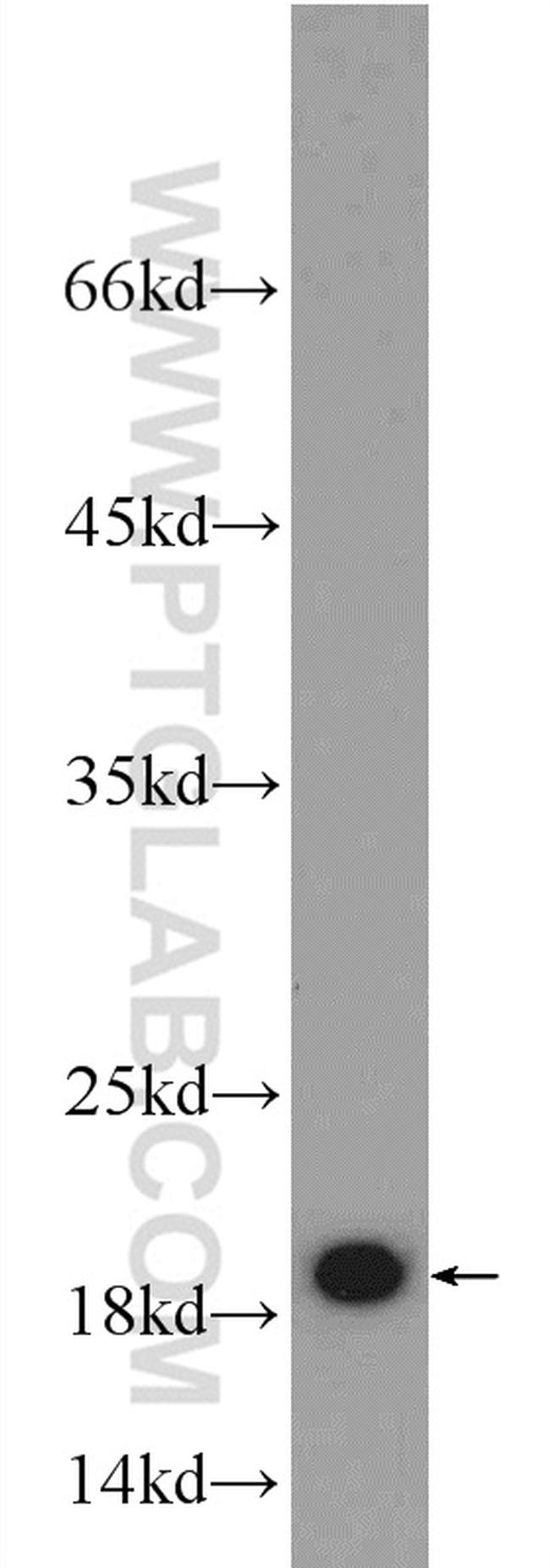 ARF1 Antibody in Western Blot (WB)