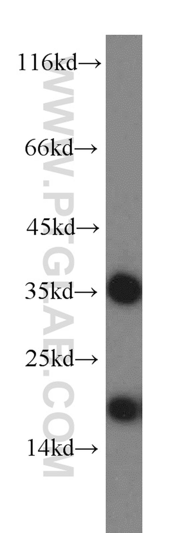 ARF1 Antibody in Western Blot (WB)