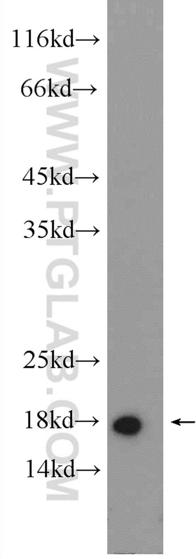 ARF1 Antibody in Western Blot (WB)