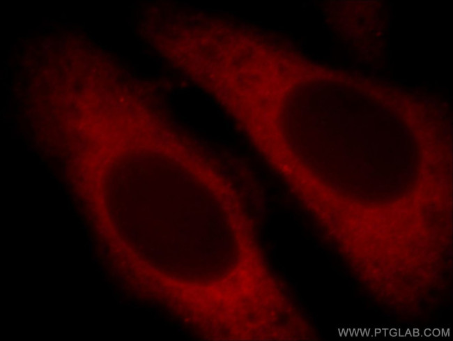 ARF5 Antibody in Immunocytochemistry (ICC/IF)