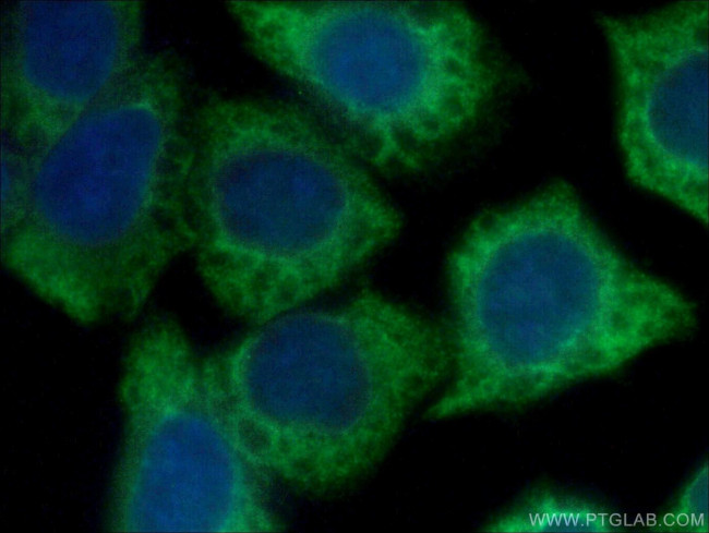 ARF5 Antibody in Immunocytochemistry (ICC/IF)