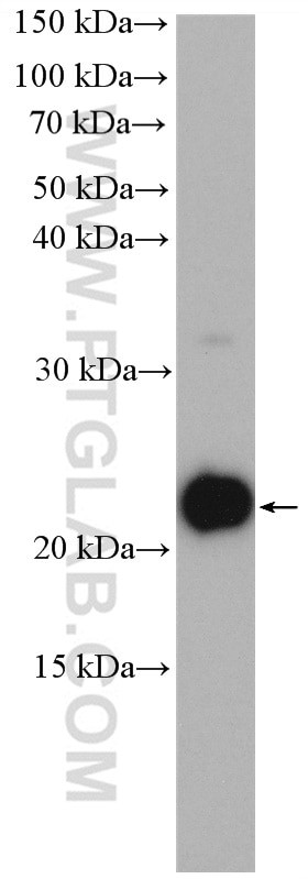 ARF5 Antibody in Western Blot (WB)